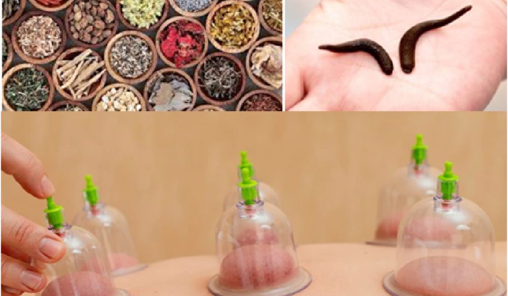 Şehir Sağlık Merkezimizde Fitoterapi , Kupa Tedavisi ve Hirudoterapi Tedavi Poliklinikleri Açılıyor.